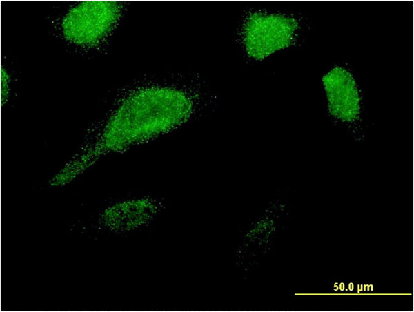 Immunofluorescence of monoclonal antibody to GLE1 on HeLa cell . [antibody concentration 10 ug/ml]