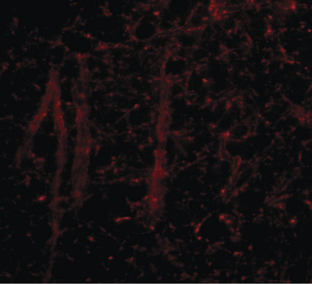 Immunofluorescence of gle1 in mouse brain tissue with gle1 antibody at 20 ug/ml.