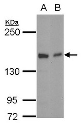Sample (30 ug of whole cell lysate) A: NT2D1 B: SK-N-SH 5% SDS PAGE GLG1 antibody diluted at 1:1000