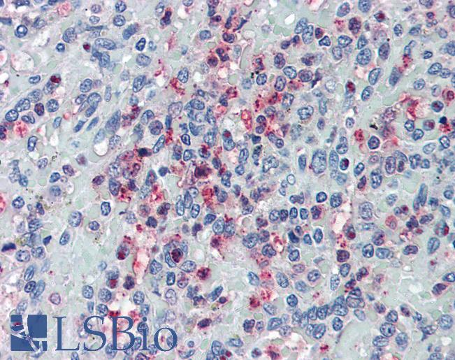 Anti-GLG1 antibody LS-A8153 IHC of human spleen. Immunohistochemistry of formalin-fixed, paraffin-embedded tissue after heat-induced antigen retrieval.
