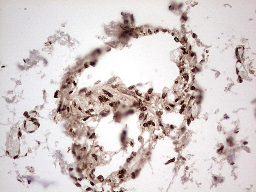 IHC of paraffin-embedded Human muscle tissue using anti-GLI1 mouse monoclonal antibody. (Heat-induced epitope retrieval by 1 mM EDTA in 10mM Tris, pH8.5, 120°C for 3min).