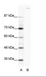 A: Marker, B: HepG2 Cell Lysate