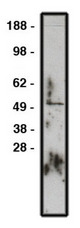 Western blot of GLI1 antibody (LS-C140618) on RMS-13 lysate. Lysate used at 15 ug/lane. Antibody used at 10 ug/ml. Secondary antibody, mouse anti-rabbit HRP, used at 1:200k dilution.