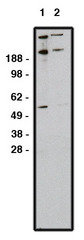 Western blot of GLI1 antibody (LS-C140617) on RMS-13 cell lysate. Lysate used at 15 ug/lane. Antibody used at 1:200 (lane 1) and 1:400 (lane 2) dilution. Secondary antibody, mouse anti-rabbit HRP, used at 1:75k dilution.