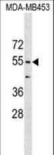 CORO1B Antibody western blot of MDA-MB453 cell line lysates (35 ug/lane). The CORO1B antibody detected the CORO1B protein (arrow).