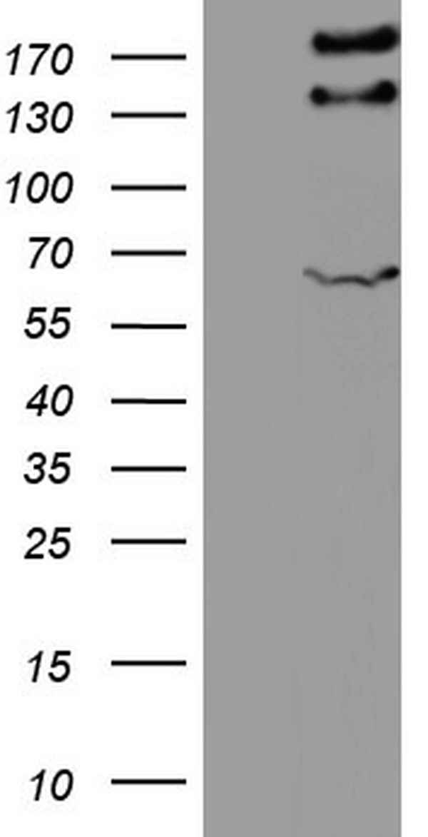 HEK293T cells were transfected with the pCMV6-ENTRY control (Left lane) or pCMV6-ENTRY GLI2 (Right lane) cDNA for 48 hrs and lysed. Equivalent amounts of cell lysates (5 ug per lane) were separated by SDS-PAGE and immunoblotted with anti-GLI2.
