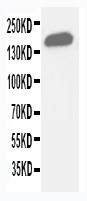 WB of GLI2 antibody. WB: Human Placenta Tissue Lysate.