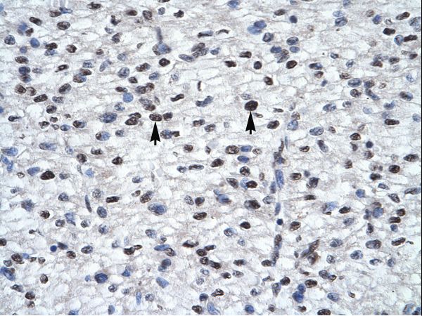 GLI2 antibody LS-C31484 was used in IHC to stain formalin-fixed, paraffin-embedded human heart.