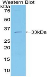 Western blot of recombinant GLI3.
