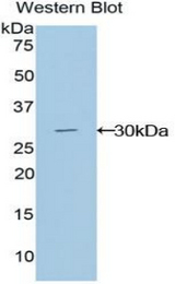 Western blot of recombinant GLI3.