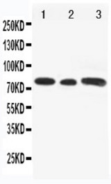 WB of GLI3 antibody. All lanes: Anti-GLI3 at 0.5ug/ml. Lane 1: Rat Testis Tissue Lysate at 40ug. Lane 2: A549 Whole Cell Lysate at 40ug. Lane 3: SW620 Whole Cell Lysate at 40ug. Predicted bind size: 170KD. Observed bind size: 80KD.