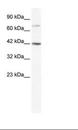Jurkat Cell Lysate