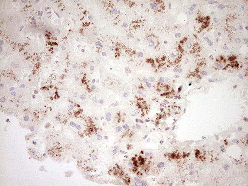 IHC of paraffin-embedded Human liver tissue using anti-GLI4 mouse monoclonal antibody. (Heat-induced epitope retrieval by 1 mM EDTA in 10mM Tris, pH8.5, 120°C for 3min).