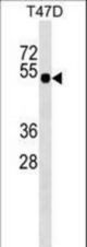 GLI4 Antibody western blot of T47D cell line lysates (35 ug/lane). The GLI4 antibody detected the GLI4 protein (arrow).