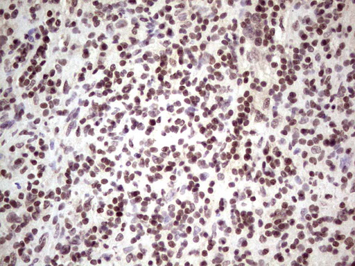 IHC of paraffin-embedded Human lymph node tissue using anti-GLI4 mouse monoclonal antibody. (Heat-induced epitope retrieval by 1 mM EDTA in 10mM Tris, pH8.5, 120°C for 3min).