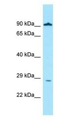 GLIPR1 / GLIPR antibody Western Blot of MCF7.