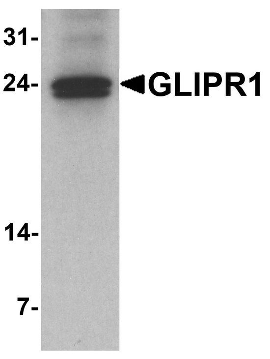 Western blot analysis of GLIPR1 in mouse small intestine tissue lysate with GLIPR1 antibody at 1 ug/ml.