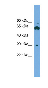 GLIPR1L1 antibody LS-C116622 Western blot of ACHN lysate.