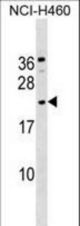 GLIPR1L1 Antibody western blot of NCI-H460 cell line lysates (35 ug/lane). The GLIPR1L1 antibody detected the GLIPR1L1 protein (arrow).