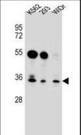 GLIPR1L2 Antibody western blot of K562,293,WiDr cell line lysates (35 ug/lane). The GLIPR1L2 antibody detected the GLIPR1L2 protein (arrow).
