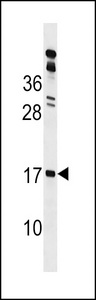 GAPR1 Antibody western blot of Y79 cell line lysates (35 ug/lane). The GAPR1 antibody detected the GAPR1 protein (arrow).