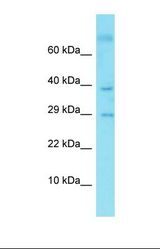 Western blot of Fetal Kidney. C9orf19 antibody dilution 1.0 ug/ml.