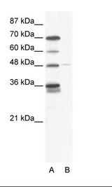 A: Marker, B: HepG2 Cell Lysate