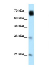 GLMN antibody LS-C102430 Western blot of HeLa Cell lysate. Antibody concentration 1 ug/ml.