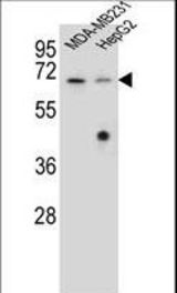 GLMN Antibody western blot of MDA-MB231,HepG2 cell line lysates (35 ug/lane). The GLMN antibody detected the GLMN protein (arrow).