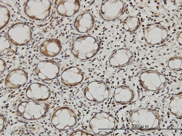 Immunoperoxidase of monoclonal antibody to QARS on formalin-fixed paraffin-embedded human colon. [antibody concentration 3 ug/ml]