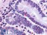 Anti-GLP2R antibody LS-A1312 IHC of human small intestine, neuroendocrine cells. Immunohistochemistry of formalin-fixed, paraffin-embedded tissue after heat-induced antigen retrieval.