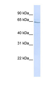 GLP2R antibody LS-C102784 Western blot of HepG2 cell lysate.