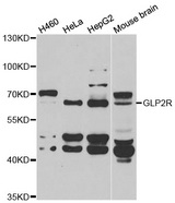 Western blot analysis of extracts of various cell lines, using GLP2R antibody.