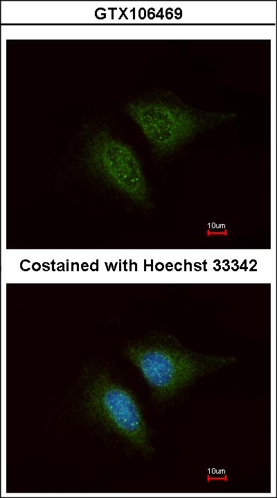 Immunofluorescence of methanol-fixed HeLa using Coronin 1C antibody at 1:200 dilution.