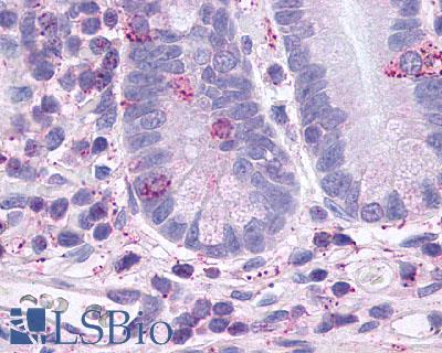 Anti-GLP2R antibody LS-A1315 IHC of human small intestine, intraepithelial neuroendocrine cells and enterocytes. Immunohistochemistry of formalin-fixed, paraffin-embedded tissue after heat-induced antigen retrieval.