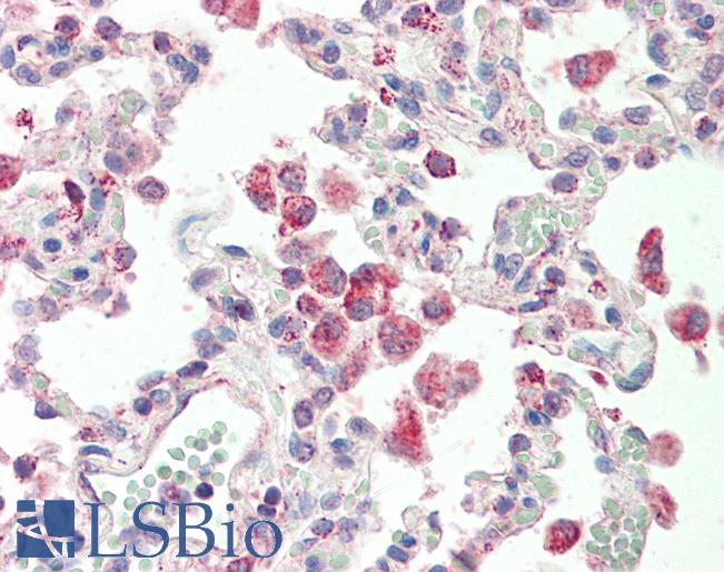 Anti-GLRA1/Glycine Receptor Alpha 1 antibody IHC staining of human lung. Immunohistochemistry of formalin-fixed, paraffin-embedded tissue after heat-induced antigen retrieval.