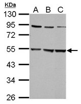 Sample (30 ug of whole cell lysate). A:293T, B: A431, C: HepG2. 10% SDS PAGE. GLRA2 antibody diluted at 1:5000.