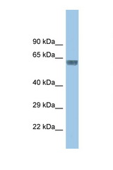 GLRA3 antibody LS-C145758 Western blot of Small Intestine lysate. Antibody concentration 1 ug/ml.