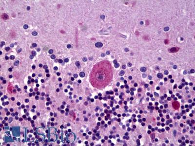 Anti-GLRA3 antibody IHC of human brain, cerebellum, Purkinje cells. Immunohistochemistry of formalin-fixed, paraffin-embedded tissue after heat-induced antigen retrieval. Antibody LS-B6671 concentration 5 ug/ml.
