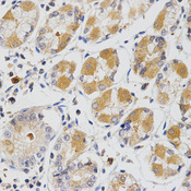 Immunohistochemistry of paraffin-embedded human stomach using GLRX antibody at dilution of 1:200 (x400 lens).