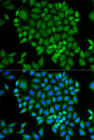 Immunofluorescence analysis of MCF-7 cell using GLRX antibody. Blue: DAPI for nuclear staining.