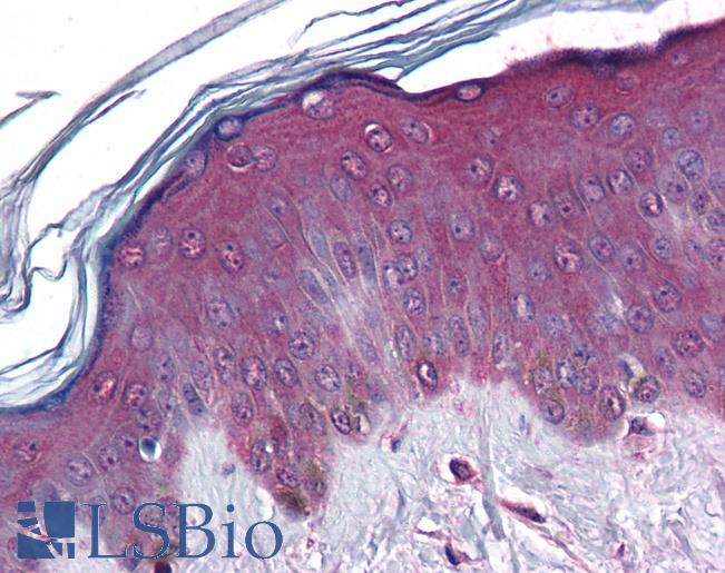 Anti-CORO1C / Coronin 3 antibody IHC of human skin. Immunohistochemistry of formalin-fixed, paraffin-embedded tissue after heat-induced antigen retrieval. Antibody LS-B6220 concentration 3 ug/ml.