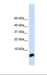 Fetal brain lysate. Antibody concentration: 1.0 ug/ml. Gel concentration: 10-20%.