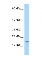 GLRX / Glutaredoxin 1 antibody LS-C146349 Western blot of Rat Lung lysate. Antibody concentration 1 ug/ml.