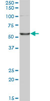 Antibody LS-B6220, Western blot of CORO1C expression in HeLa NE.