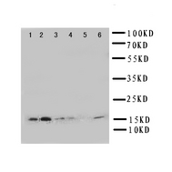 WB of GLRX2 / Glutaredoxin 2 antibody. Lane 1: Rat Testis Tissue Lysate. Lane 2: HELA Cell Lysate. Lane 3: U87 Cell Lysate. Lane 4: NEU Cell Lysate. Lane 5: JURKAT Cell Lysate. Lane 6: MCF-7 Cell Lysate.