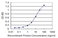Detection limit for recombinant GST tagged CORO1C is 0.1 ng/ml as a capture antibody.