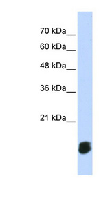 GLRX5 antibody LS-C102720 Western blot of Transfected 293T cell lysate.