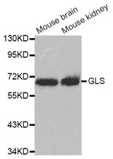 Western blot analysis of extracts of various cell lines, using GLS antibody.
