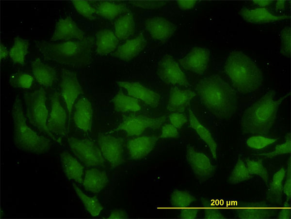 Immunofluorescence of monoclonal antibody to GLS on HeLa cell. [antibody concentration 10 ug/ml]